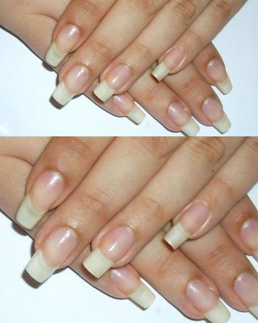 Empower Your Nails: Harnessing Natural Remedies for Stronger, Healthier Nail Care