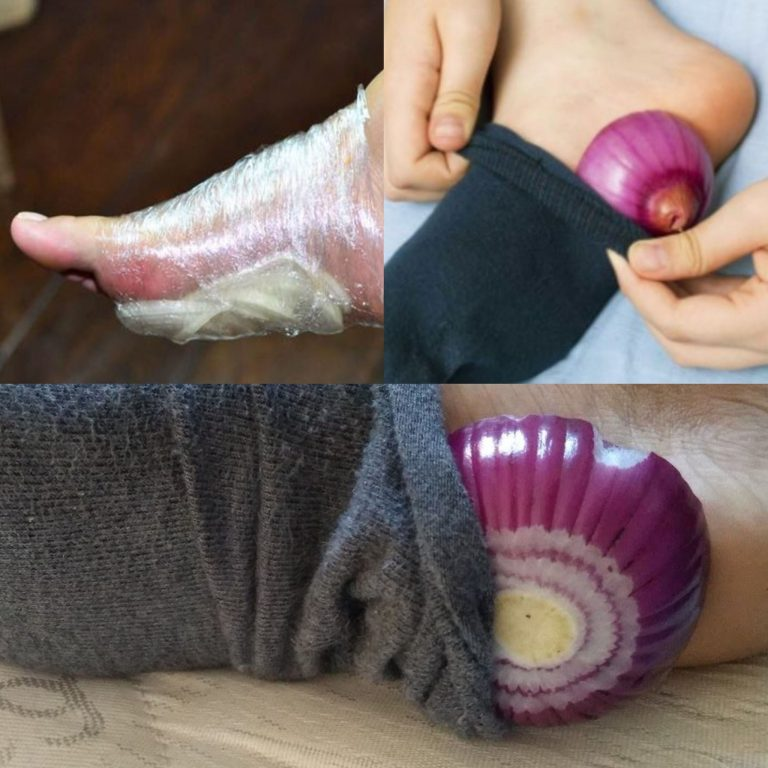 What Happens When You Sleep with Onion in Your Socks?