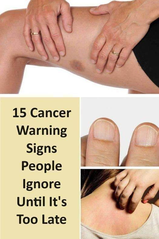 15 Cancer Warning Signs People Ignore Until It’s Too Late