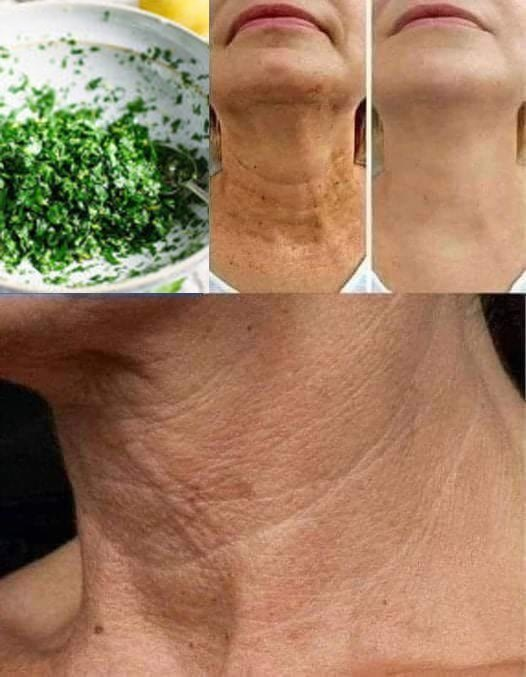 Homemade Mask Getting Rid of Wrinkles and Spots