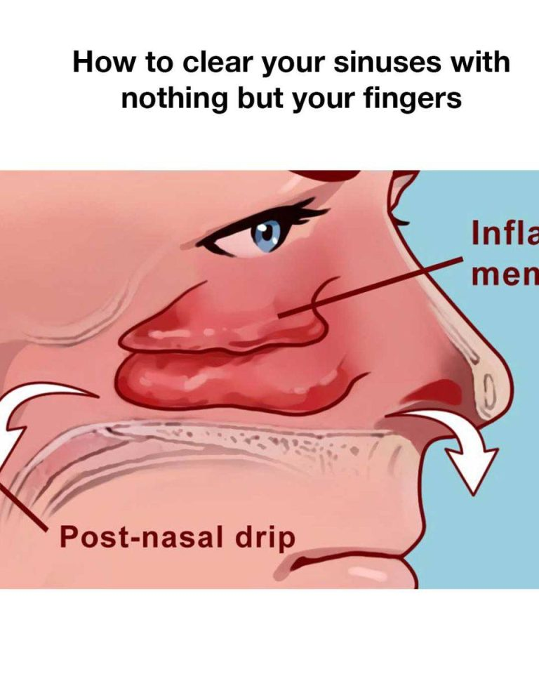 How to clear your sinuses in seconds with nothing but your fingers