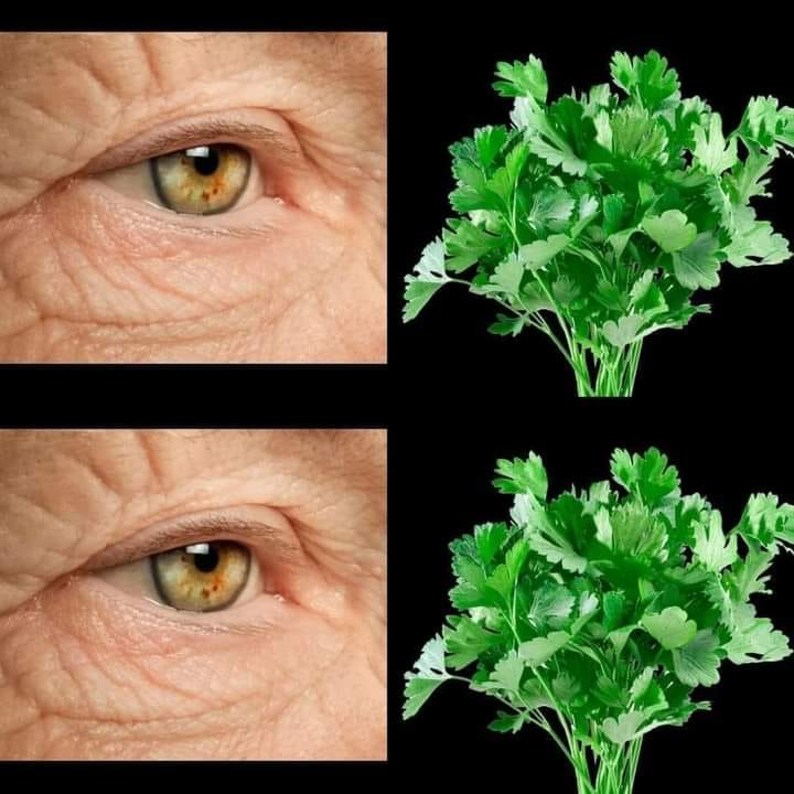 Why Parsley Works for Vision